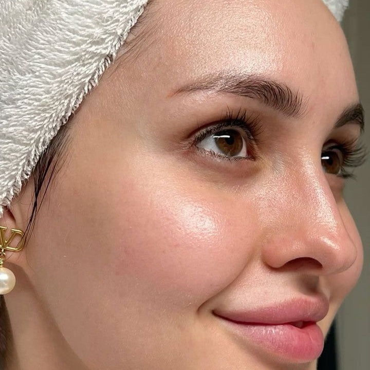 Water Tank Blackhead Remover Device for Clear Skin