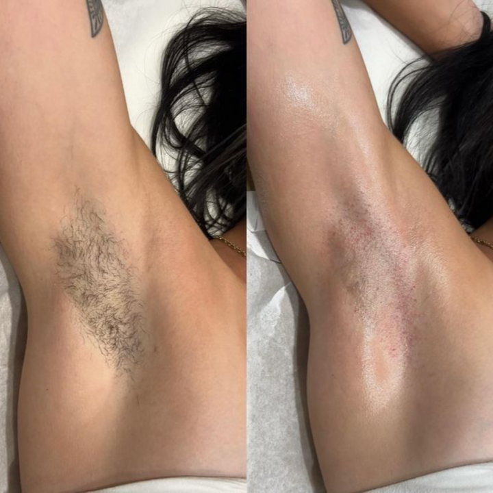 Crystal Hair Removal Tool