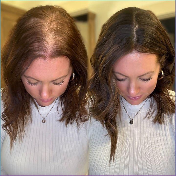 Electric Hair Massager with Red Light Therapy for Scalp Relaxation