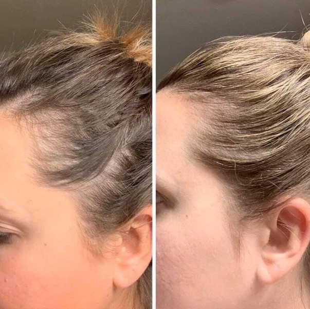Electric Hair Oil Applicator Tool for Easy and Precise Application