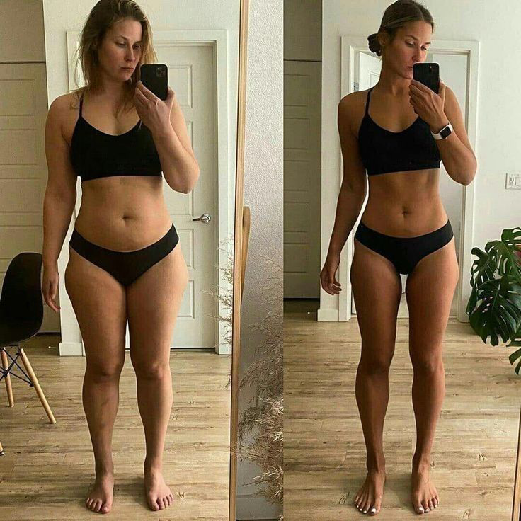 Slimming Ultrasonic Machine for Anti-Cellulite Treatment